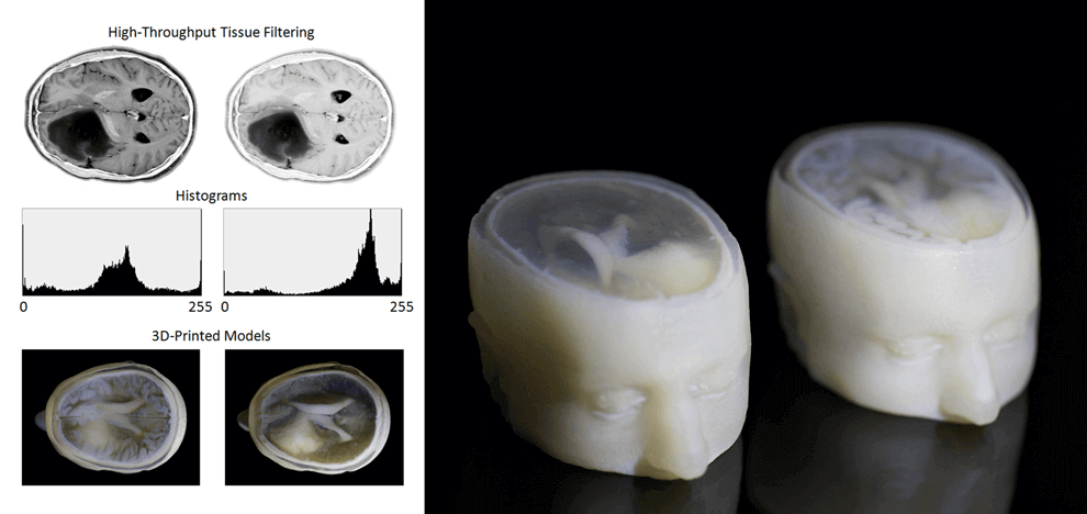 improved-diagnostics-presurgical-planning-high-resolution-functionally-graded-multi-material-3d-printing-biomedical-tomographic-datasets-3 improved-diagnostics-presurgical-planning-high-resolution-functionally-graded-multi-material-3d-printing-biomedical-tomographic-datasets-3
